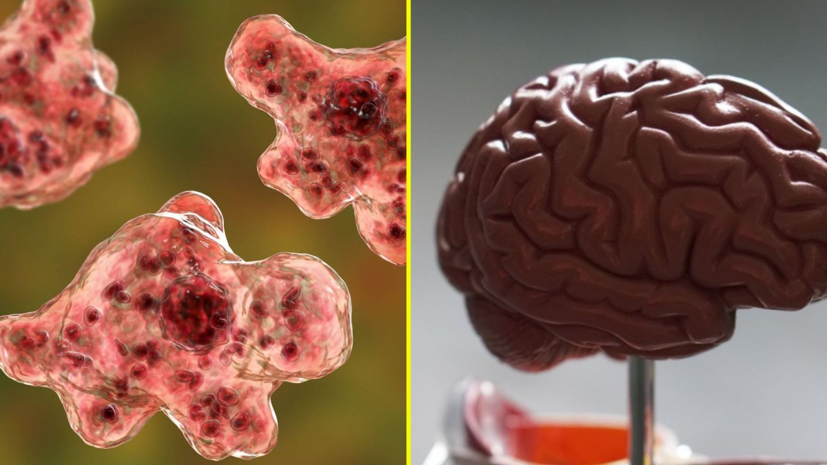 Tragedia en Estados Unidos: Niña de 8 años muere tras infectarse con la «ameba comecerebros»